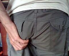 Cómo reconocer la presencia de parásitos en el cuerpo