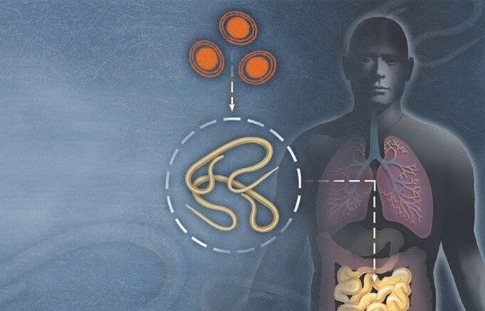Parásitos en el intestino humano.