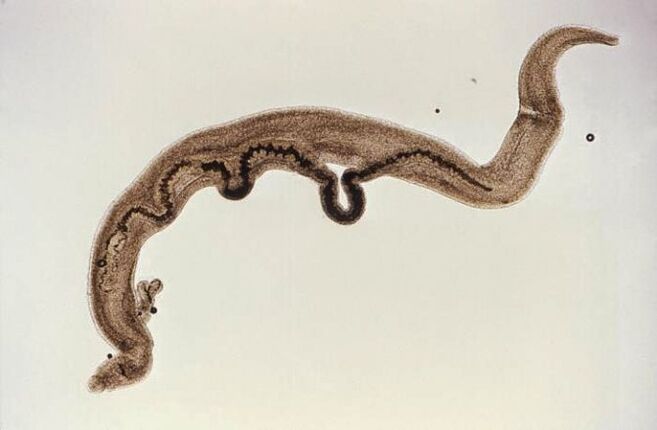 Parásito esquistosoma dentro del cuerpo.