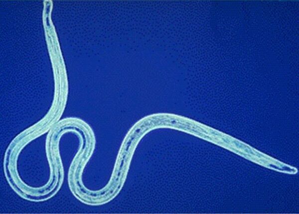 nematodos en el cuerpo humano