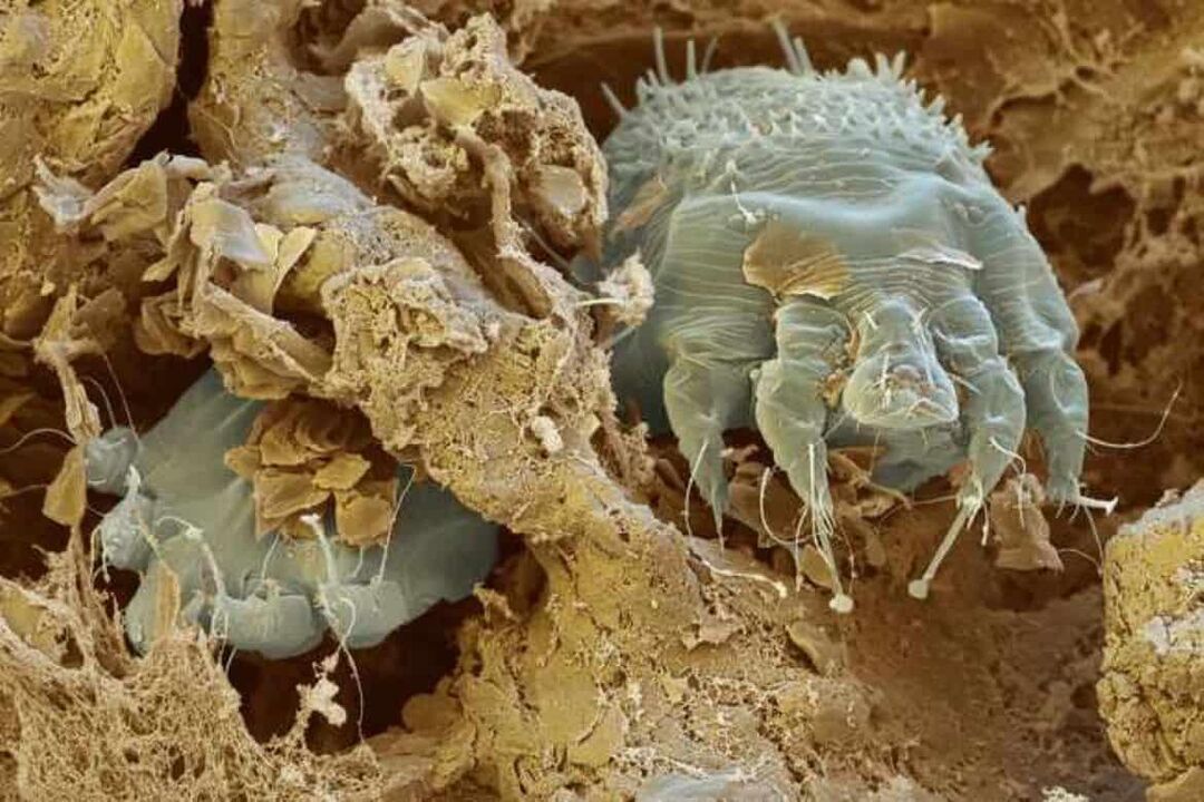 ácaro de la sarna bajo un microscopio