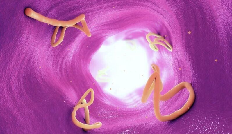 Helmintos en el intestino humano.