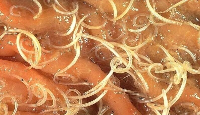 gusanos del cuerpo humano