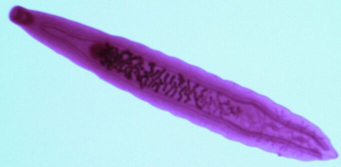 parásito trematodo del cuerpo humano